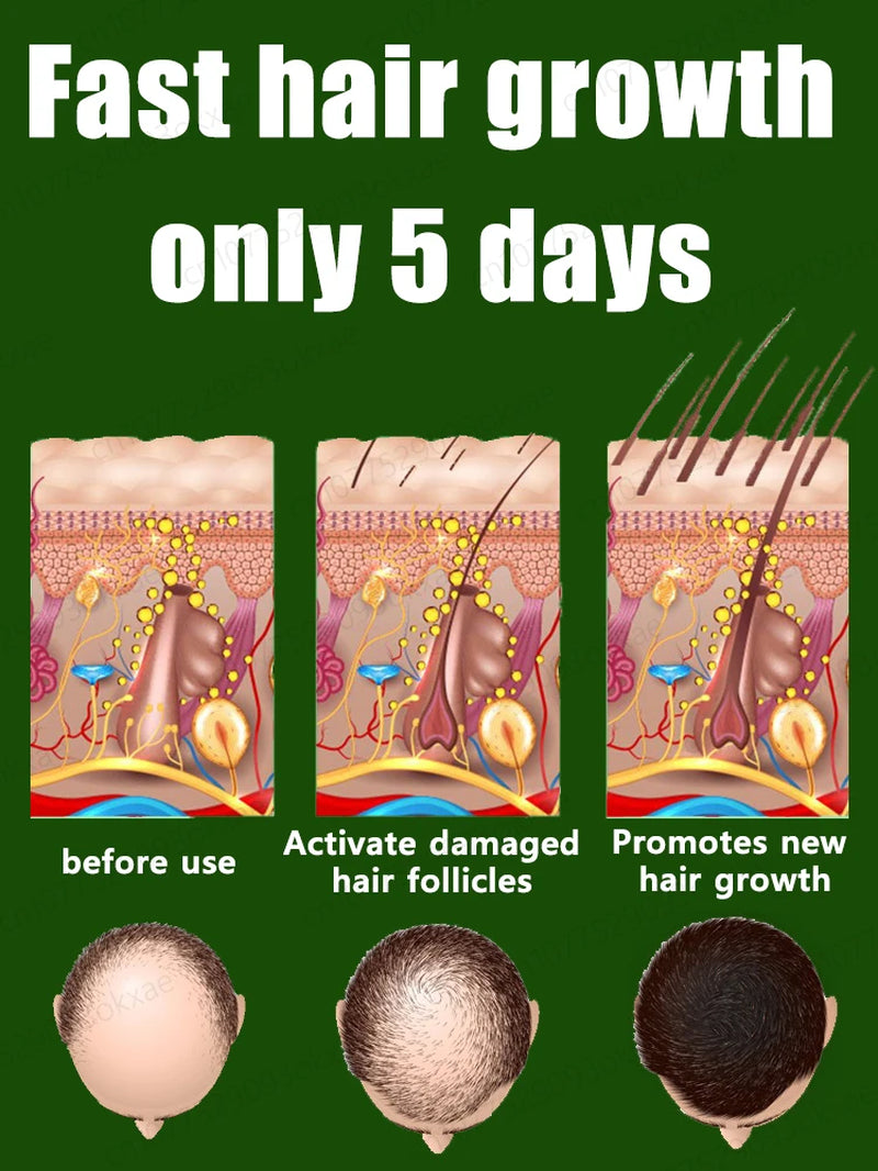 Anti Alopecia Fast Hair Growth Oil Ginger Essential Serum
