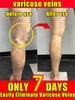 Effective Varicose Vein Relief Cream Ointment for Varicose Veins to Relieve Vasculitis Phlebitis Spider Pain Treatment