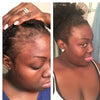 Anti Alopecia Oil Hair Growth Essential Oils for Black Women Essence Anti-Hair Loss Hair Serum for Thinning Hair Thickening