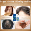 Powerful Hair Growth Serum Spray anti Hairs Loss Products Treatment Oil Repair Nourish Roots Regrowth Liquid for Men Women 30Ml